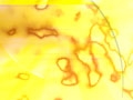 1771621